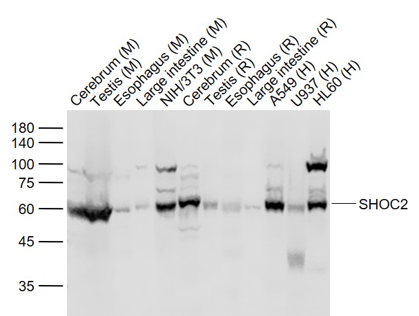 Lane 1: Mouse Cerebrum lysates; Lane 2: Mouse Testis lysates; Lane 3: Mouse Esophagus lysates; Lane 4: Mouse Large intestine lysates; Lane 5: Mouse NIH/3T3 cell lysates; Lane 6: Rat Cerebrum lysates; Lane 7: Rat Testis lysates; Lane 8: Rat Esophagus lysates; Lane 9: Rat Large intestine lysates; Lane 10: Human A549 cell lysates; Lane 11: Human U937 cell lysates； Lane 12: Human HL-60 cell lysates probed with SHOC2 Polyclonal Antibody, Unconjugated (bs-7934R) at 1:1000 dilution and 4˚C overnight incubation. Followed by conjugated secondary antibody incubation at 1:20000 for 60 min at 37˚C.