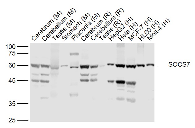 Lane 1: Mouse Cerebrum lysates; Lane 2: Mouse Cerebellum lysates; Lane 3: Mouse Testis lysates; Lane 4: Mouse Stomach lysates; Lane 5: Mouse Placenta lysates; Lane 6: Rat Cerebrum lysates; Lane 7: Rat Cerebellum lysates; Lane 8: Rat Testis lysates; Lane 9: Human HepG2 cell lysates; Lane 10: Human Hela cell lysates; Lane 11: Human MCF-7 cell lysates; Lane 12: Human HL-60 cell lysates; Lane 13: Human MOLT-4 cell lysates probed with SOCS7 Polyclonal Antibody, Unconjugated (bs-20151R) at 1:1000 dilution and 4˚C overnight incubation. Followed by conjugated secondary antibody incubation at 1:20000 for 60 min at 37˚C. Lane 1: Mouse Cerebrum lysates; Lane 2: Mouse Cerebellum lysates; Lane 3: Mouse Testis lysates; Lane 4: Mouse Stomach lysates; Lane 5: Mouse Placenta lysates; Lane 6: Rat Cerebrum lysates; Lane 7: Rat Cerebellum lysates; Lane 8: Rat Testis lysates; Lane 9: Human HepG2 cell lysates; Lane 10: Human Hela cell lysates; Lane 11: Human MCF-7 cell lysates; Lane 12: Human HL-60 cell lysates; Lane 13: Human MOLT-4 cell lysates probed with SOCS7 Polyclonal Antibody, Unconjugated (bs-20151R) at 1:1000 dilution and 4˚C overnight incubation. Followed by conjugated secondary antibody incubation at 1:20000 for 60 min at 37˚C.