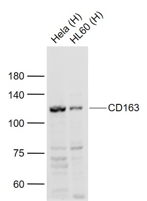 Lane 1: Human Hela cell lysates; Lane 2: Human HL-60 cell lysates probed with CD163 Polyclonal Antibody, Unconjugated (bs-23128R) at 1:1000 dilution and 4˚C overnight incubation. Followed by conjugated secondary antibody incubation at 1:20000 for 60 min at 37˚C