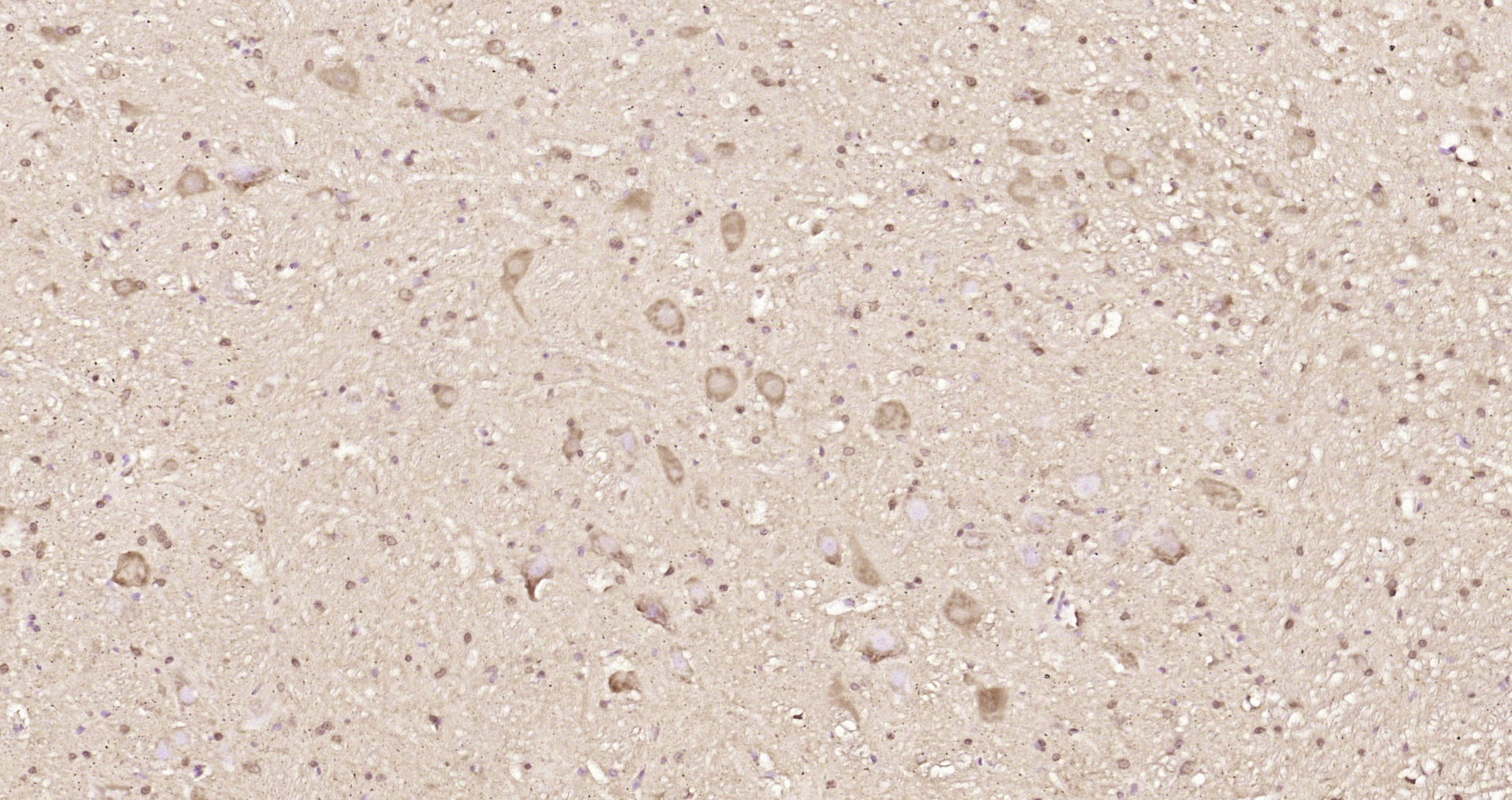 Paraformaldehyde-fixed, paraffin embedded Rat cerebellum; Antigen retrieval by boiling in sodium citrate buffer (pH6.0) for 15min; Block endogenous peroxidase by 3% hydrogen peroxide for 20 minutes; Blocking buffer (normal goat serum) at 37°C for 30min; Antibody incubation with RINT1 Polyclonal Antibody, Unconjugated (bs-7828R) at 1:200 overnight at 4°C, DAB staining.