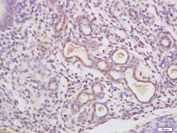 Formalin-fixed and paraffin embedded rat uterus labeled with Anti Nucleolin/C23 Polyclonal Antibody, Unconjugated (bs-8536R) at 1:200 followed by conjugation to the secondary antibody and DAB staining