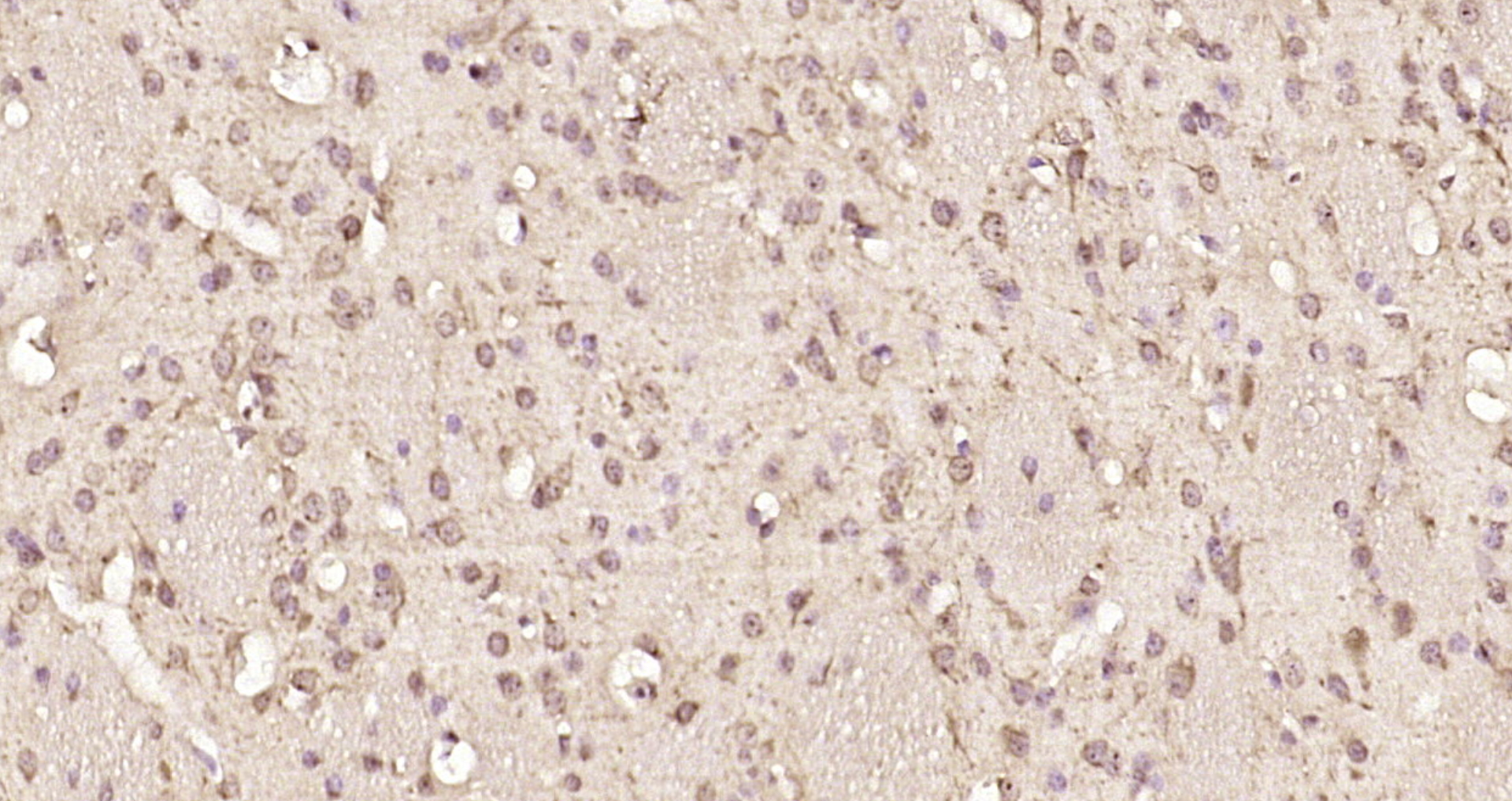 Paraformaldehyde-fixed, paraffin embedded Mouse brain; Antigen retrieval by boiling in sodium citrate buffer (pH6.0) for 15min; Block endogenous peroxidase by 3% hydrogen peroxide for 20 minutes; Blocking buffer (normal goat serum) at 37°C for 30min; Antibody incubation with NUP160 Polyclonal Antibody, Unconjugated (bs-7843R) at 1:200 overnight at 4°C, DAB staining.