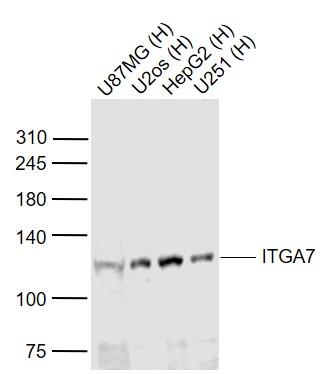 Lane 1: Human U87MG cell lysates; Lane 2: Human U2os cell lysates; Lane 3: Human HepG2 cell lysates; Lane 4: Human U251 cell lysates probed with Integrin alpha 7 Polyclonal Antibody, Unconjugated (bs-1816R) at 1:1000 dilution and 4˚C overnight incubation. Followed by conjugated secondary antibody incubation at 1:20000 for 60 min at 37˚C.