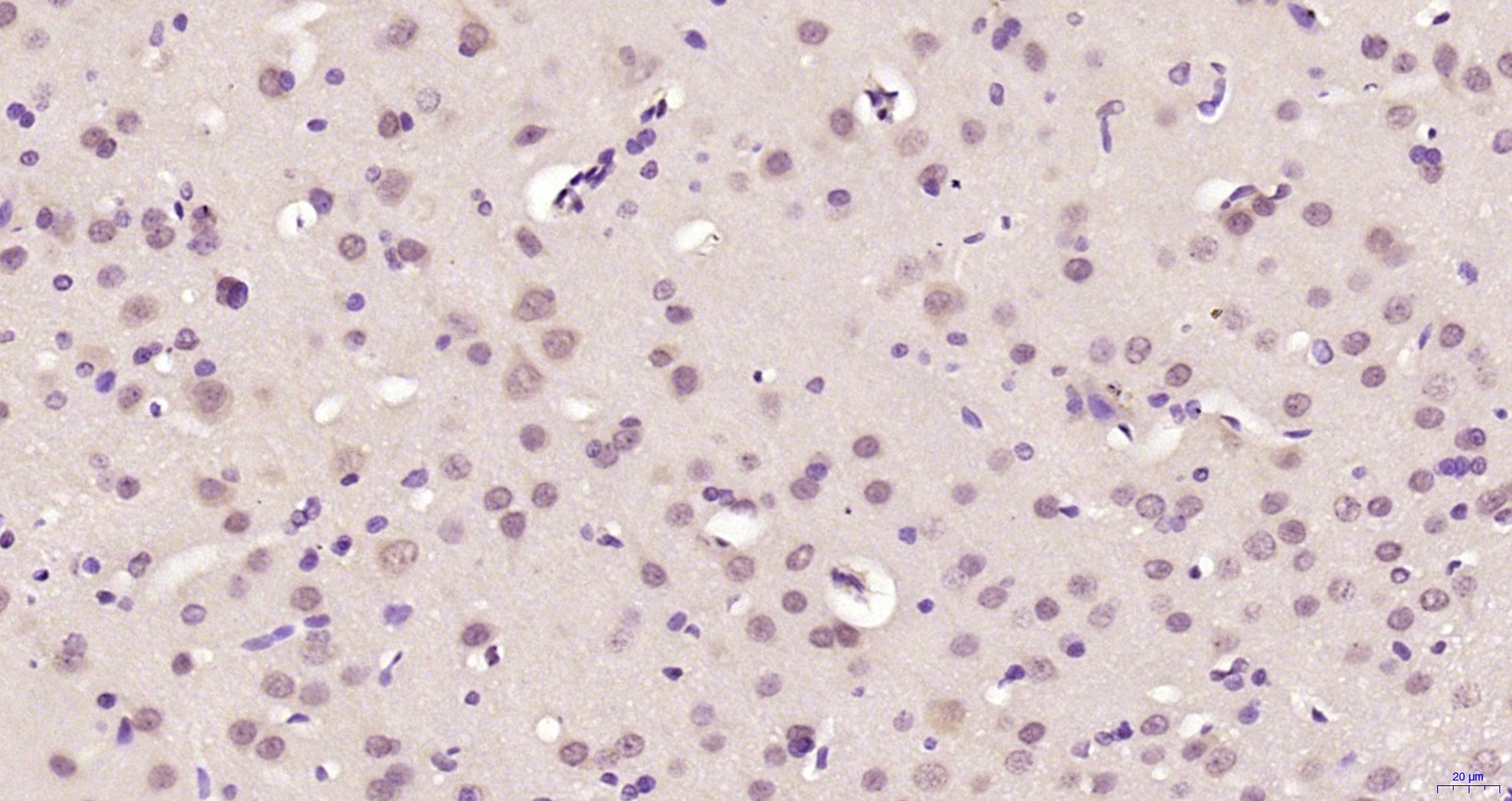 Paraformaldehyde-fixed, paraffin embedded Rat brain; Antigen retrieval by boiling in sodium citrate buffer (pH6.0) for 15min; Block endogenous peroxidase by 3% hydrogen peroxide for 20 minutes; Blocking buffer (normal goat serum) at 37°C for 30min; Antibody incubation with PPHLN1 Polyclonal Antibody, Unconjugated (bs-7872R) at 1:200 overnight at 4°C, DAB staining. Paraformaldehyde-fixed, paraffin embedded Rat brain; Antigen retrieval by boiling in sodium citrate buffer (pH6.0) for 15min; Block endogenous peroxidase by 3% hydrogen peroxide for 20 minutes; Blocking buffer (normal goat serum) at 37°C for 30min; Antibody incubation with PPHLN1 Polyclonal Antibody, Unconjugated (bs-7872R) at 1:200 overnight at 4°C, DAB staining.
