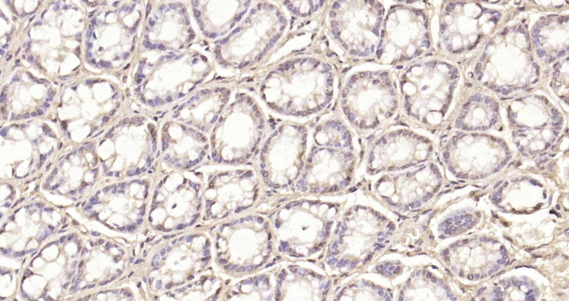 Paraformaldehyde-fixed, paraffin embedded Rat colon; Antigen retrieval by boiling in sodium citrate buffer (pH6.0) for 15min; Block endogenous peroxidase by 3% hydrogen peroxide for 20 minutes; Blocking buffer (normal goat serum) at 37°C for 30min; Antibody incubation with MNAT1 Polyclonal Antibody, Unconjugated (bs-7896R) at 1:200 overnight at 4°C, DAB staining. Paraformaldehyde-fixed, paraffin embedded Rat colon; Antigen retrieval by boiling in sodium citrate buffer (pH6.0) for 15min; Block endogenous peroxidase by 3% hydrogen peroxide for 20 minutes; Blocking buffer (normal goat serum) at 37°C for 30min; Antibody incubation with MNAT1 Polyclonal Antibody, Unconjugated (bs-7896R) at 1:200 overnight at 4°C, DAB staining.