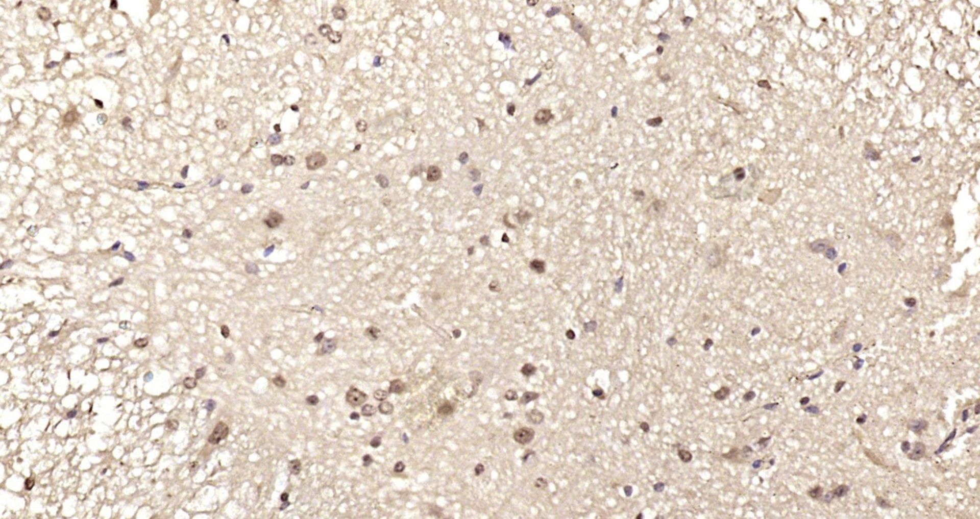 Paraformaldehyde-fixed, paraffin embedded Mouse spinal cord; Antigen retrieval by boiling in sodium citrate buffer (pH6.0) for 15min; Block endogenous peroxidase by 3% hydrogen peroxide for 20 minutes; Blocking buffer (normal goat serum) at 37°C for 30min; Antibody incubation with MOBKL2B Polyclonal Antibody, Unconjugated (bs-7914R) at 1:200 overnight at 4°C, DAB staining.