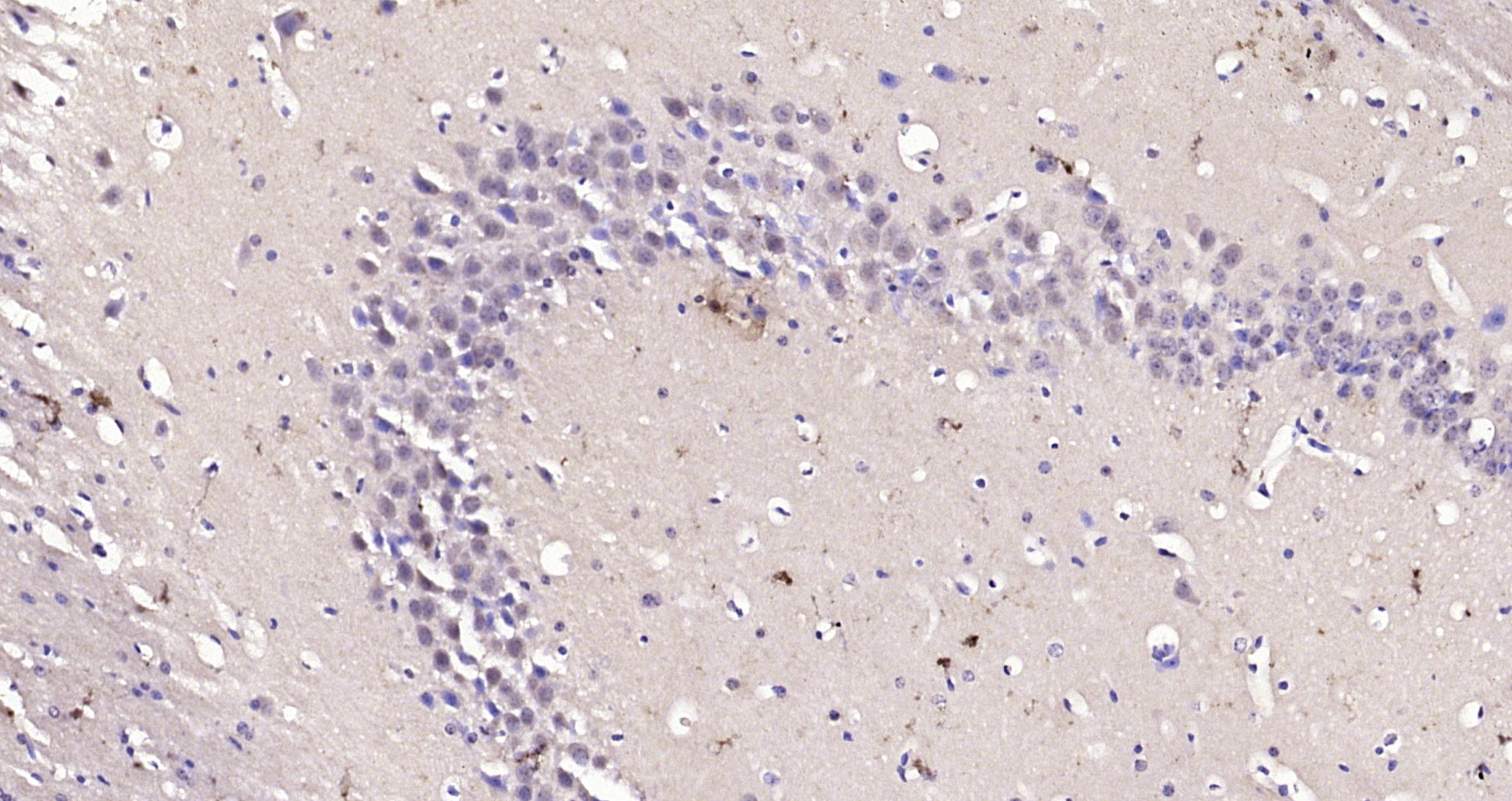 Paraformaldehyde-fixed, paraffin embedded Mouse brain; Antigen retrieval by boiling in sodium citrate buffer (pH6.0) for 15min; Block endogenous peroxidase by 3% hydrogen peroxide for 20 minutes; Blocking buffer (normal goat serum) at 37°C for 30min; Antibody incubation with NSD1 Polyclonal Antibody, Unconjugated (bs-8170R) at 1:200 overnight at 4°C, DAB staining.