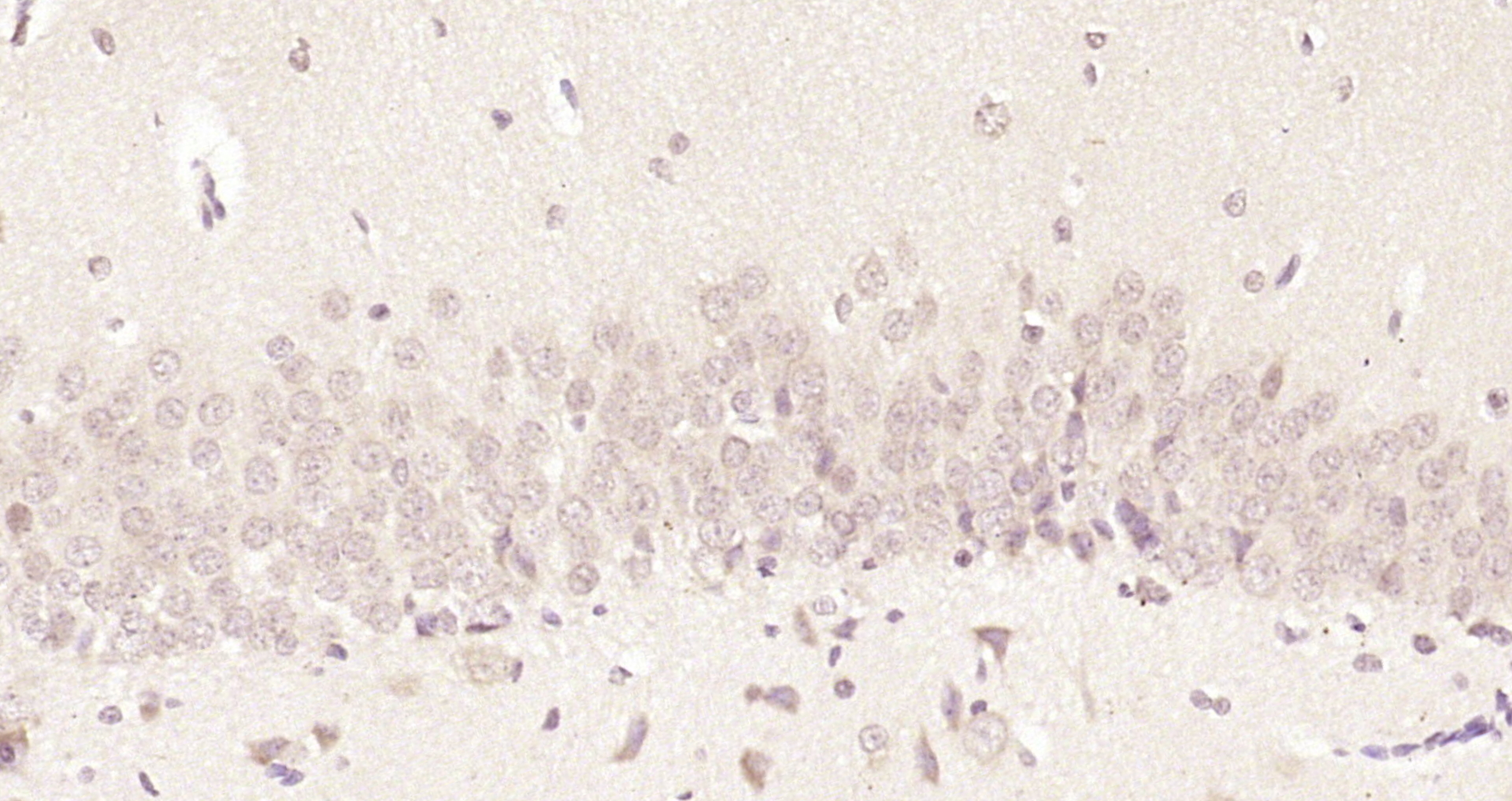 Paraformaldehyde-fixed, paraffin embedded Rat brain; Antigen retrieval by boiling in sodium citrate buffer (pH6.0) for 15min; Block endogenous peroxidase by 3% hydrogen peroxide for 20 minutes; Blocking buffer (normal goat serum) at 37°C for 30min; Antibody incubation with FAM46C Polyclonal Antibody, Unconjugated (bs-8198R) at 1:200 overnight at 4°C, DAB staining.