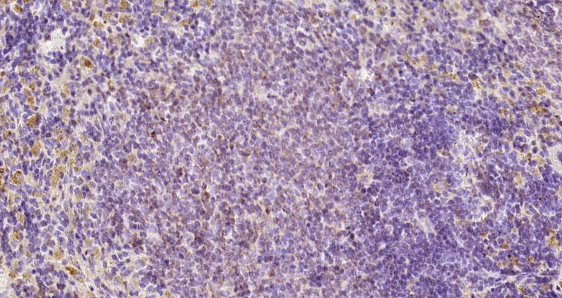 Paraformaldehyde-fixed, paraffin embedded Rat spleen; Antigen retrieval by boiling in sodium citrate buffer (pH6.0) for 15min; Block endogenous peroxidase by 3% hydrogen peroxide for 20 minutes; Blocking buffer (normal goat serum) at 37°C for 30min; Antibody incubation with FAM46C Polyclonal Antibody, Unconjugated (bs-8198R) at 1:200 overnight at 4°C, DAB staining.