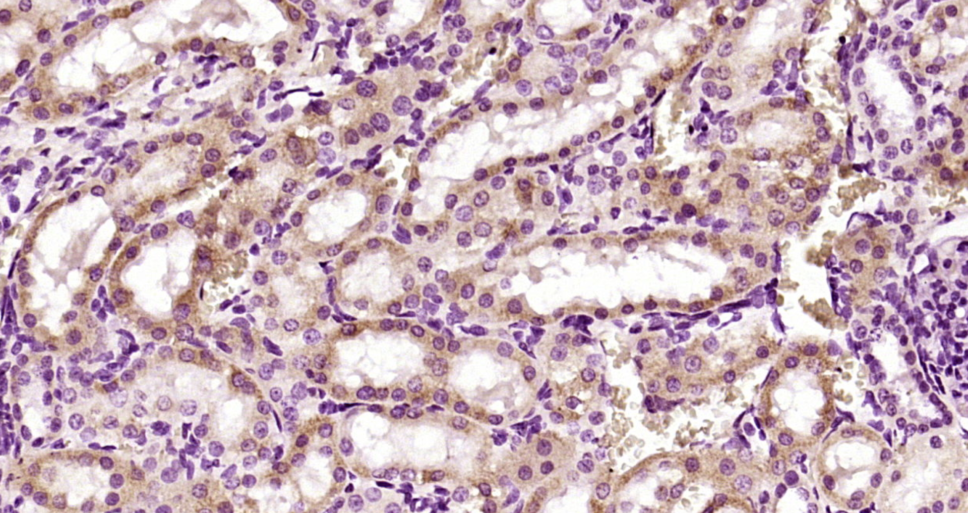 Paraformaldehyde-fixed, paraffin embedded Rat kidney; Antigen retrieval by boiling in sodium citrate buffer (pH6.0) for 15min; Block endogenous peroxidase by 3% hydrogen peroxide for 20 minutes; Blocking buffer (normal goat serum) at 37°C for 30min; Antibody incubation with PANK4 Polyclonal Antibody, Unconjugated (bs-8340R) at 1:200 overnight at 4°C, DAB staining.
