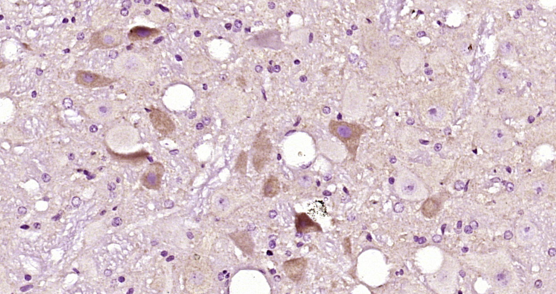 Paraformaldehyde-fixed, paraffin embedded Rat brain; Antigen retrieval by boiling in sodium citrate buffer (pH6.0) for 15min; Block endogenous peroxidase by 3% hydrogen peroxide for 20 minutes; Blocking buffer (normal goat serum) at 37°C for 30min; Antibody incubation with PANK4 Polyclonal Antibody, Unconjugated (bs-8340R) at 1:200 overnight at 4°C, DAB staining.