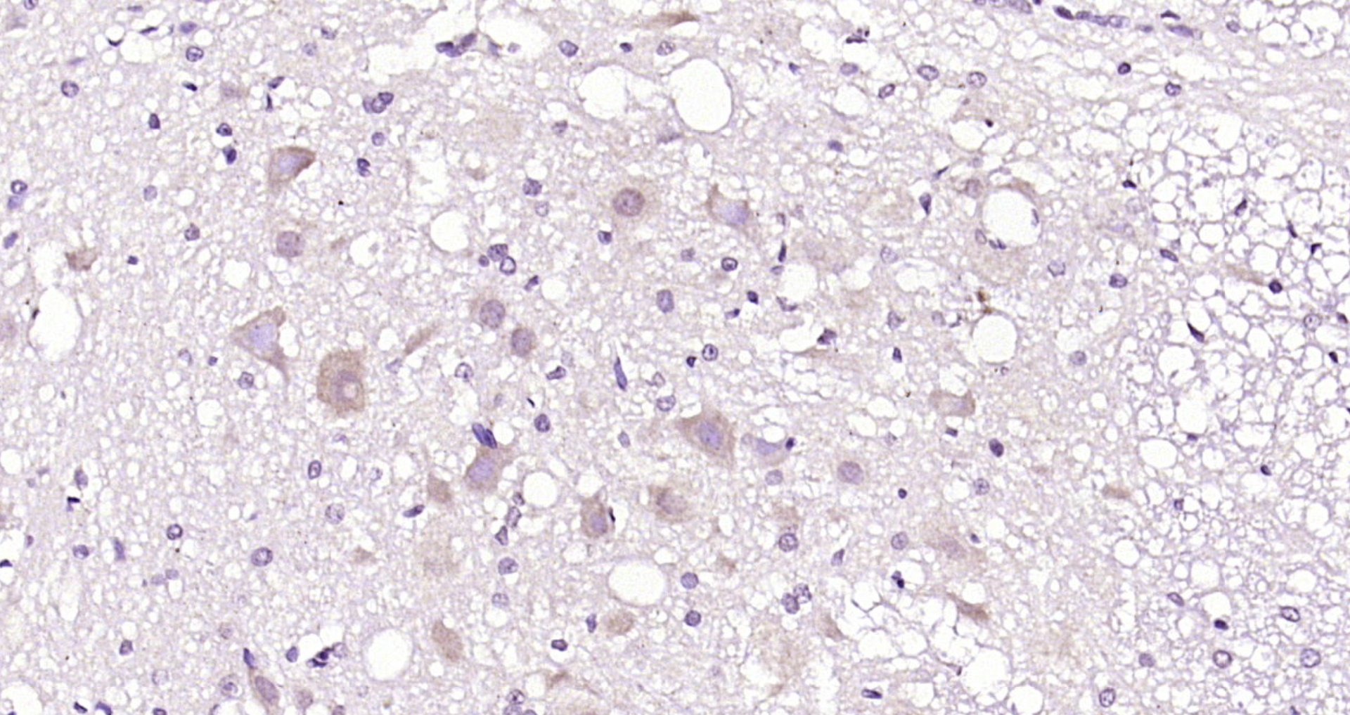 Paraformaldehyde-fixed, paraffin embedded Rat brain; Antigen retrieval by boiling in sodium citrate buffer (pH6.0) for 15min; Block endogenous peroxidase by 3% hydrogen peroxide for 20 minutes; Blocking buffer (normal goat serum) at 37°C for 30min; Antibody incubation with LRRC59 Polyclonal Antibody, Unconjugated (bs-8361R) at 1:200 overnight at 4°C, DAB staining.