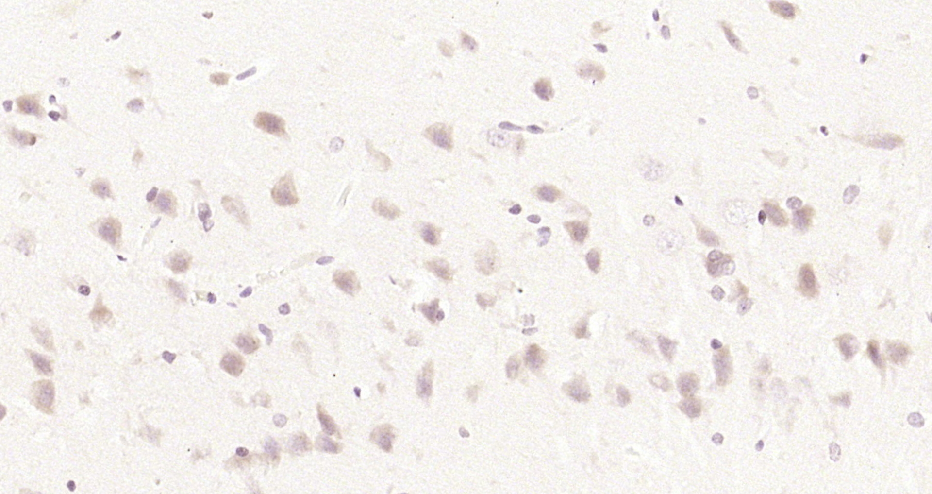 Paraformaldehyde-fixed, paraffin embedded Rat brain; Antigen retrieval by boiling in sodium citrate buffer (pH6.0) for 15min; Block endogenous peroxidase by 3% hydrogen peroxide for 20 minutes; Blocking buffer (normal goat serum) at 37°C for 30min; Antibody incubation with FBXW8 Polyclonal Antibody, Unconjugated (bs-8395R) at 1:200 overnight at 4°C, DAB staining.