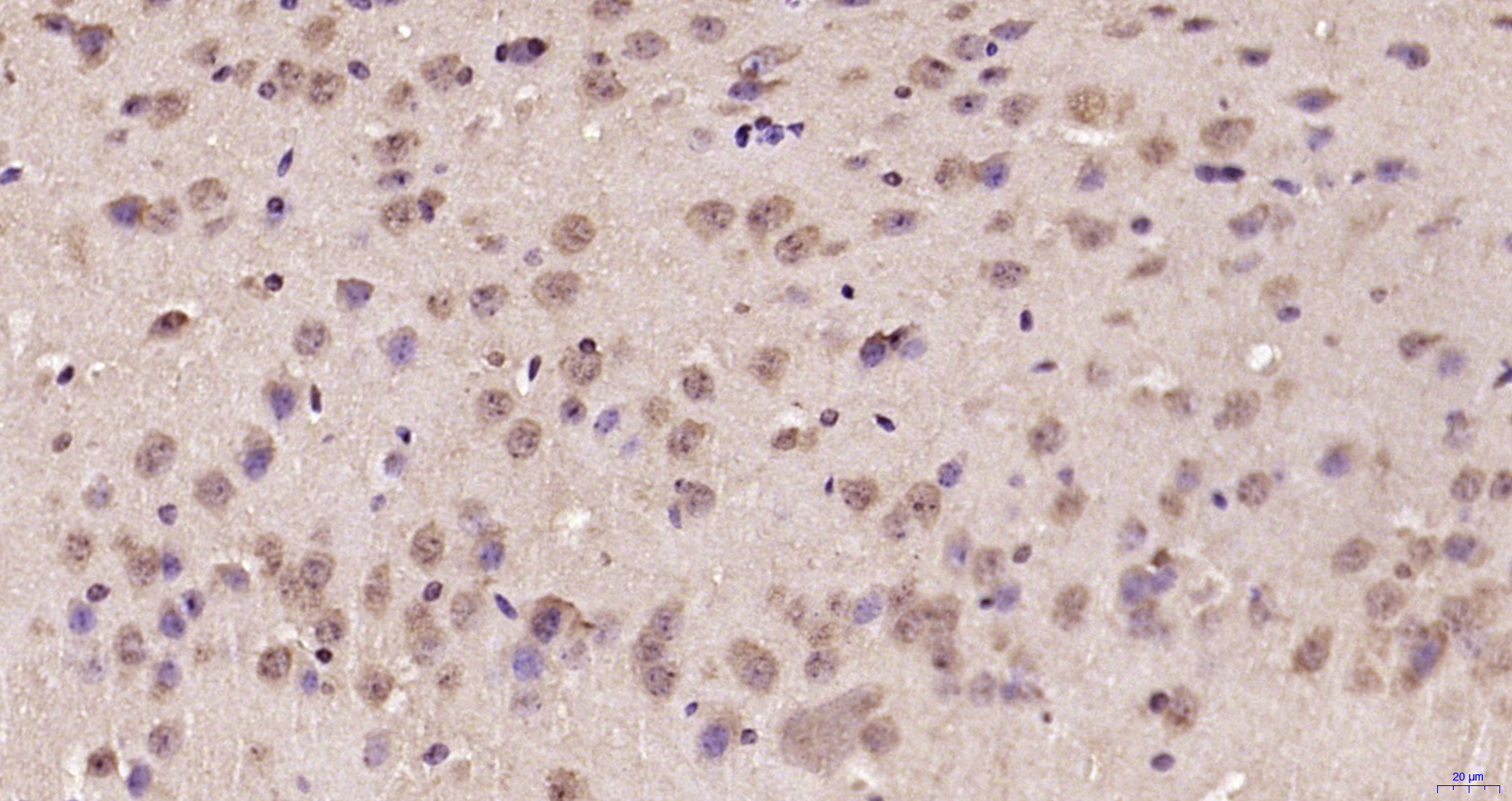 Paraformaldehyde-fixed, paraffin embedded Mouse brain; Antigen retrieval by boiling in sodium citrate buffer (pH6.0) for 15min; Block endogenous peroxidase by 3% hydrogen peroxide for 20 minutes; Blocking buffer (normal goat serum) at 37°C for 30min; Antibody incubation with BTBD19 Polyclonal Antibody, Unconjugated (bs-8401R) at 1:200 overnight at 4°C, DAB staining.