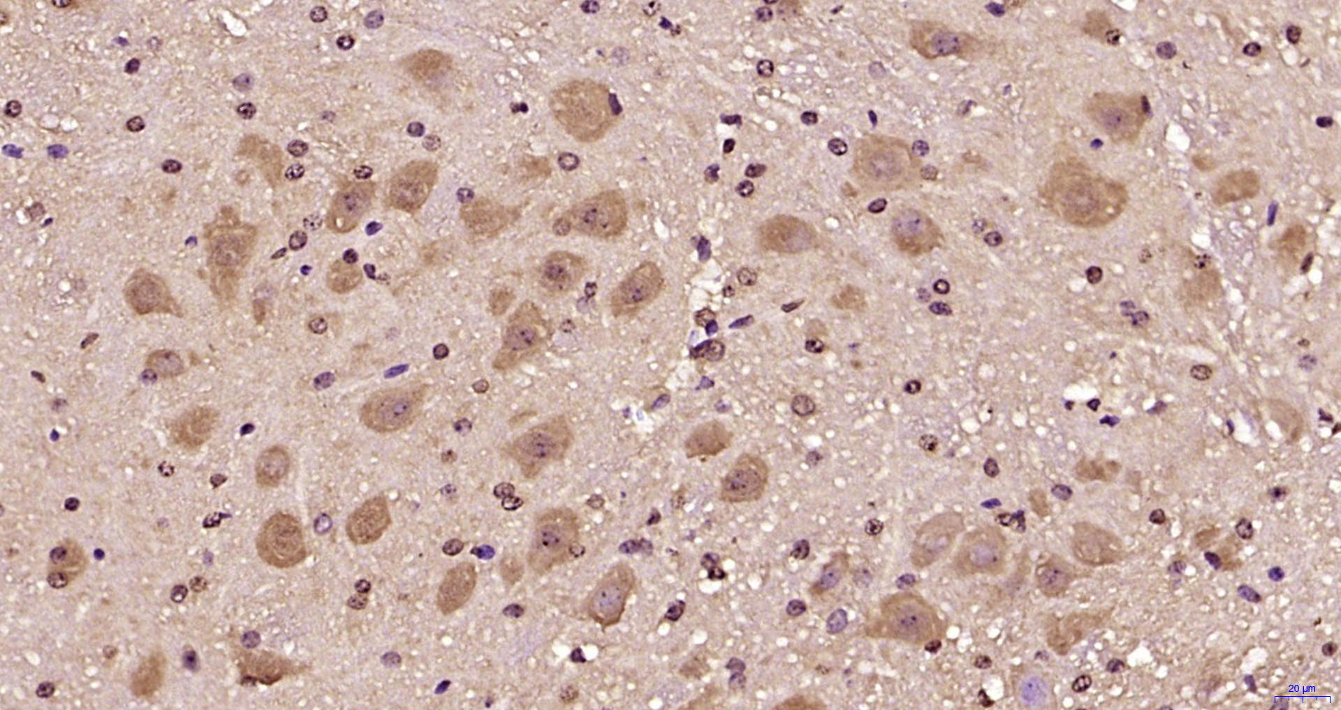 Paraformaldehyde-fixed, paraffin embedded Mouse cerebellum; Antigen retrieval by boiling in sodium citrate buffer (pH6.0) for 15min; Block endogenous peroxidase by 3% hydrogen peroxide for 20 minutes; Blocking buffer (normal goat serum) at 37°C for 30min; Antibody incubation with BTBD19 Polyclonal Antibody, Unconjugated (bs-8401R) at 1:200 overnight at 4°C, DAB staining.