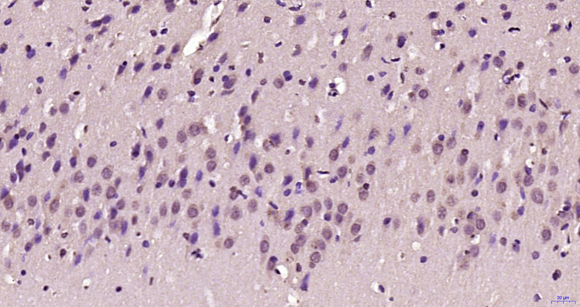 Paraformaldehyde-fixed, paraffin embedded Rat brain; Antigen retrieval by boiling in sodium citrate buffer (pH6.0) for 15min; Block endogenous peroxidase by 3% hydrogen peroxide for 20 minutes; Blocking buffer (normal goat serum) at 37°C for 30min; Antibody incubation with BTBD19 Polyclonal Antibody, Unconjugated (bs-8401R) at 1:200 overnight at 4°C, DAB staining.