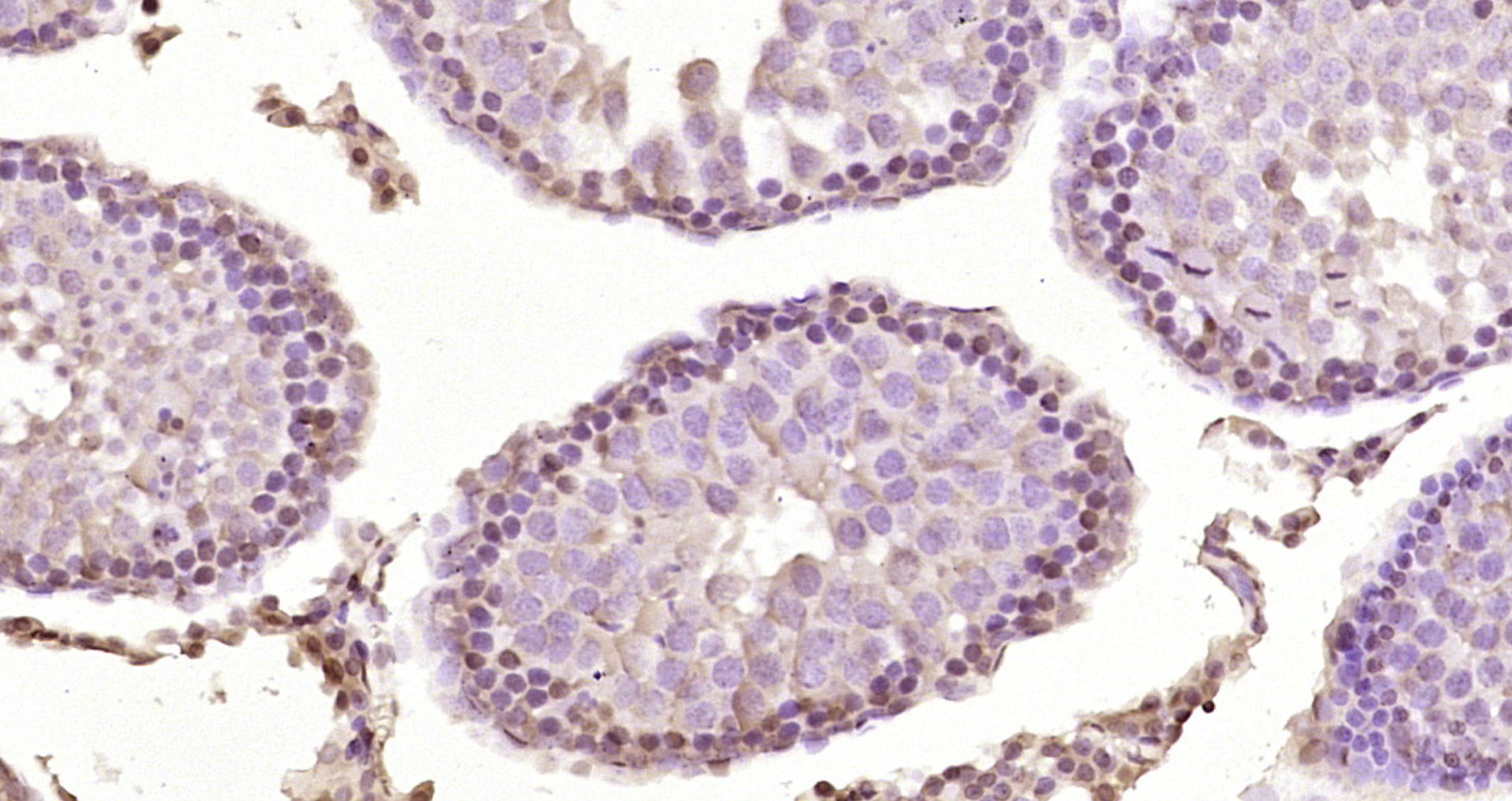Paraformaldehyde-fixed, paraffin embedded Rat testis; Antigen retrieval by boiling in sodium citrate buffer (pH6.0) for 15min; Block endogenous peroxidase by 3% hydrogen peroxide for 20 minutes; Blocking buffer (normal goat serum) at 37°C for 30min; Antibody incubation with FNDC8 Polyclonal Antibody, Unconjugated (bs-8488R) at 1:200 overnight at 4°C, DAB staining.