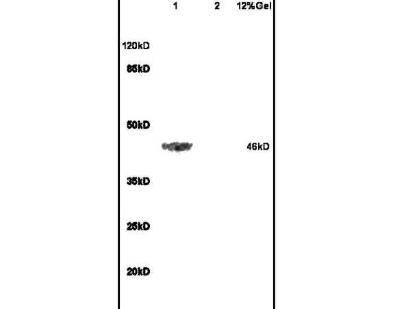 L1 rat brain lysates L2 rat heart lysates probed with Anti ADRB2 Polyclonal Antibody, Unconjugated (bs-0947R) at 1:200 in 4˚C. Followed by conjugation to secondary antibody (bs-0295G-HRP) at 1:3000 90min in 37˚C. Predicted band 46kD. Observed band size: 46kD