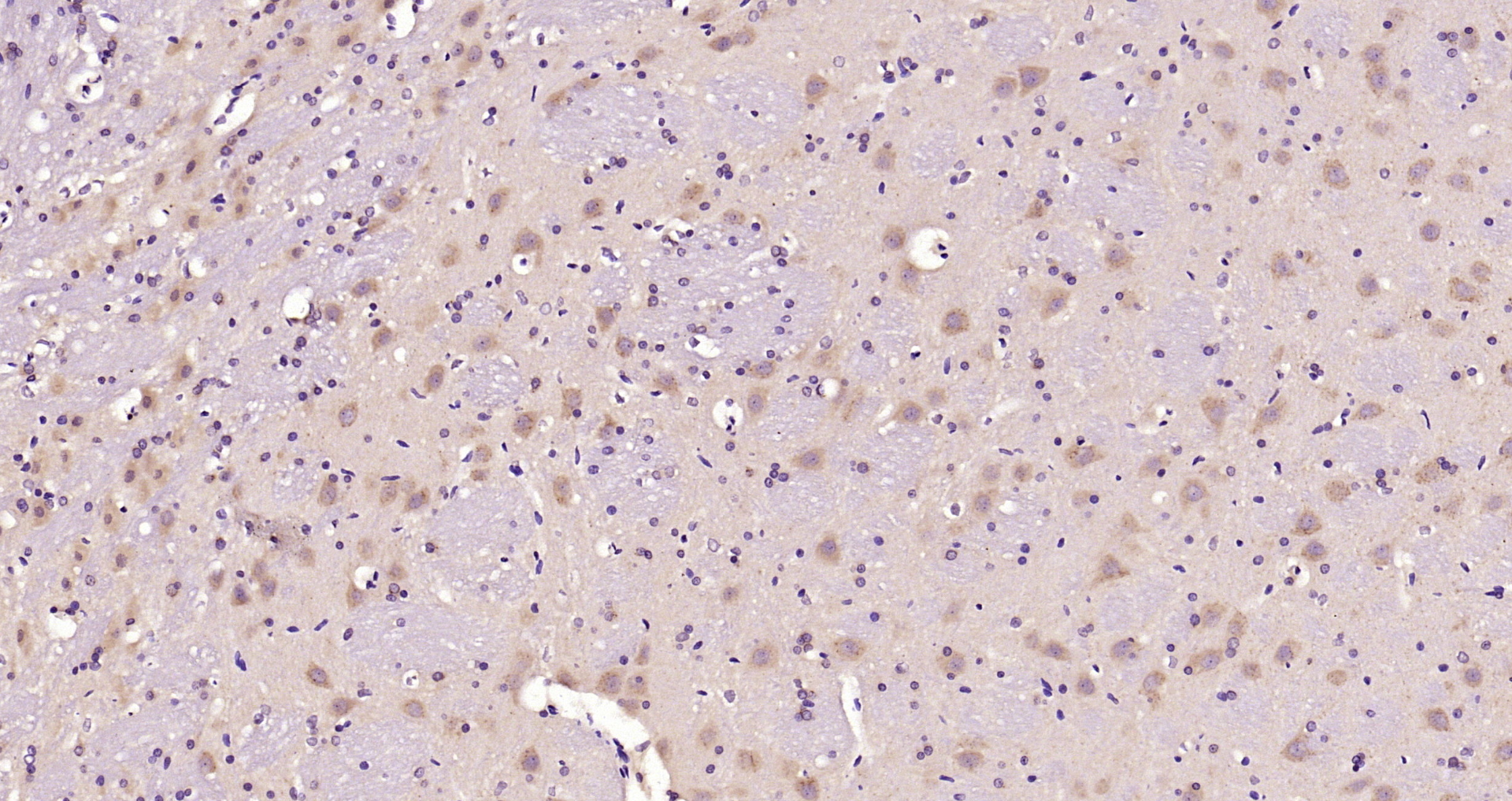 Paraformaldehyde-fixed, paraffin embedded Rat brain; Antigen retrieval by boiling in sodium citrate buffer (pH6.0) for 15min; Block endogenous peroxidase by 3% hydrogen peroxide for 20 minutes; Blocking buffer (normal goat serum) at 37°C for 30min; Antibody incubation with PERK Polyclonal Antibody, Unconjugated (bs-2469R) at 1:200 overnight at 4°C, DAB staining.
