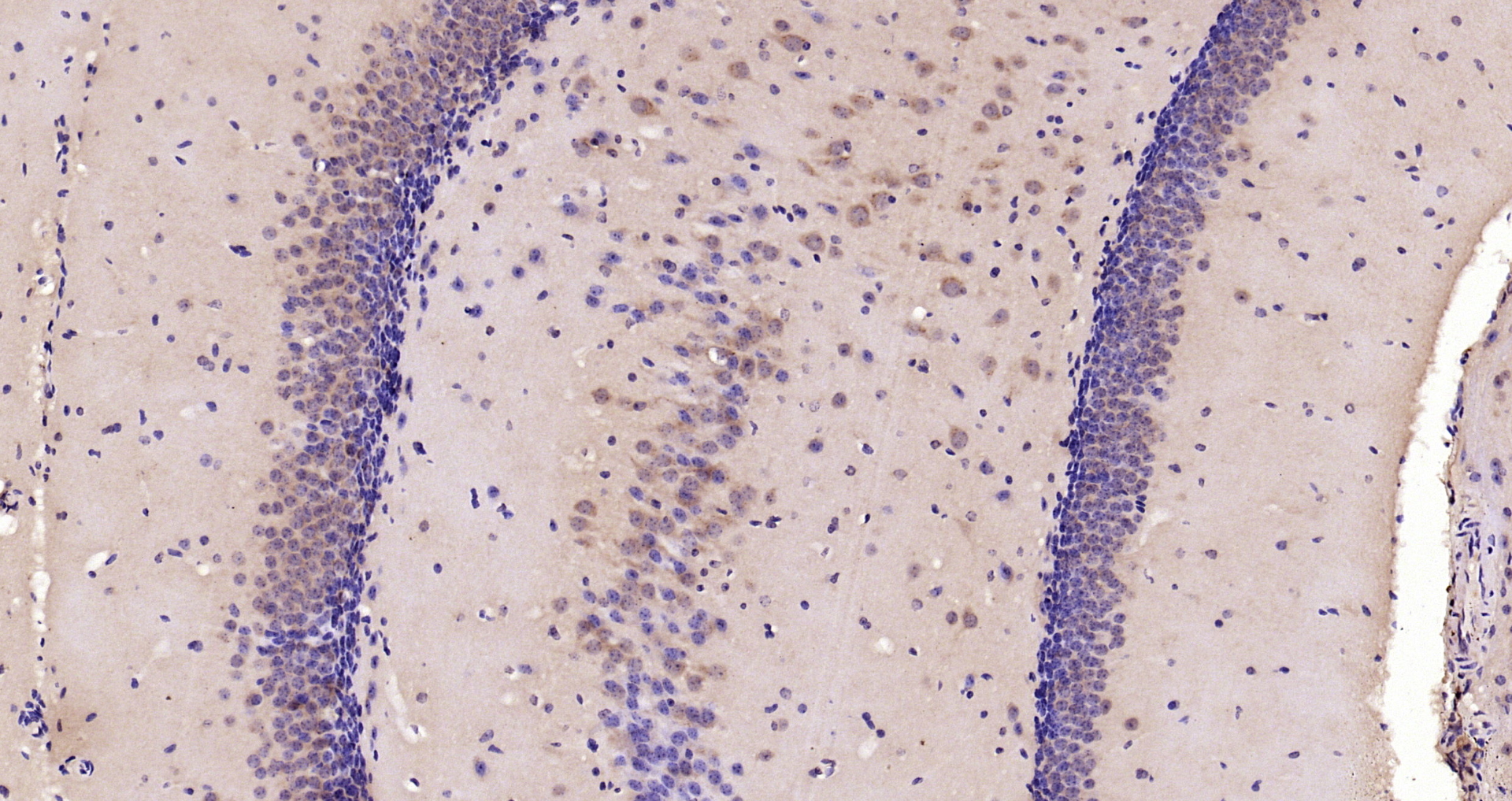Paraformaldehyde-fixed, paraffin embedded Mouse brain; Antigen retrieval by boiling in sodium citrate buffer (pH6.0) for 15min; Block endogenous peroxidase by 3% hydrogen peroxide for 20 minutes; Blocking buffer (normal goat serum) at 37°C for 30min; Antibody incubation with PERK Polyclonal Antibody, Unconjugated (bs-2469R) at 1:200 overnight at 4°C, DAB staining.