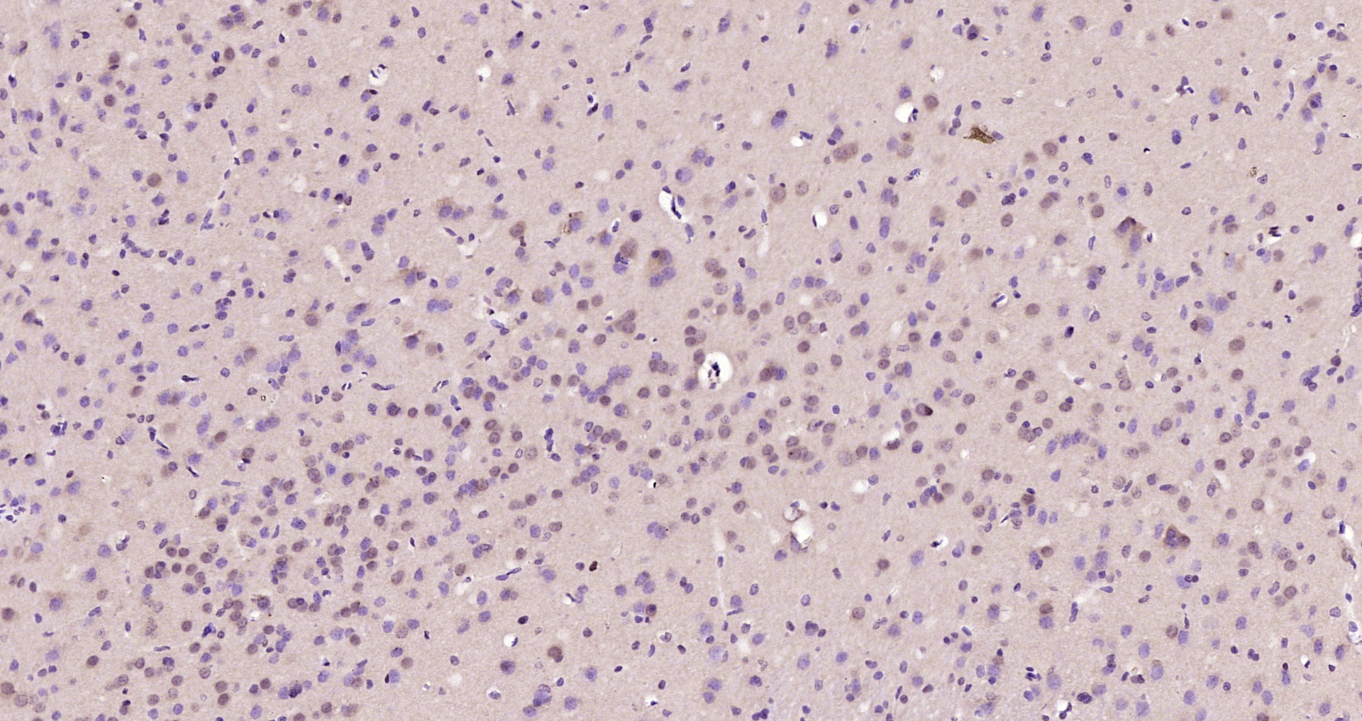 Paraformaldehyde-fixed, paraffin embedded Rat brain; Antigen retrieval by boiling in sodium citrate buffer (pH6.0) for 15min; Block endogenous peroxidase by 3% hydrogen peroxide for 20 minutes; Blocking buffer (normal goat serum) at 37°C for 30min; Antibody incubation with AKIRIN1 Polyclonal Antibody, Unconjugated (bs-9081R) at 1:200 overnight at 4°C, DAB staining. Paraformaldehyde-fixed, paraffin embedded Rat brain; Antigen retrieval by boiling in sodium citrate buffer (pH6.0) for 15min; Block endogenous peroxidase by 3% hydrogen peroxide for 20 minutes; Blocking buffer (normal goat serum) at 37°C for 30min; Antibody incubation with AKIRIN1 Polyclonal Antibody, Unconjugated (bs-9081R) at 1:200 overnight at 4°C, DAB staining.