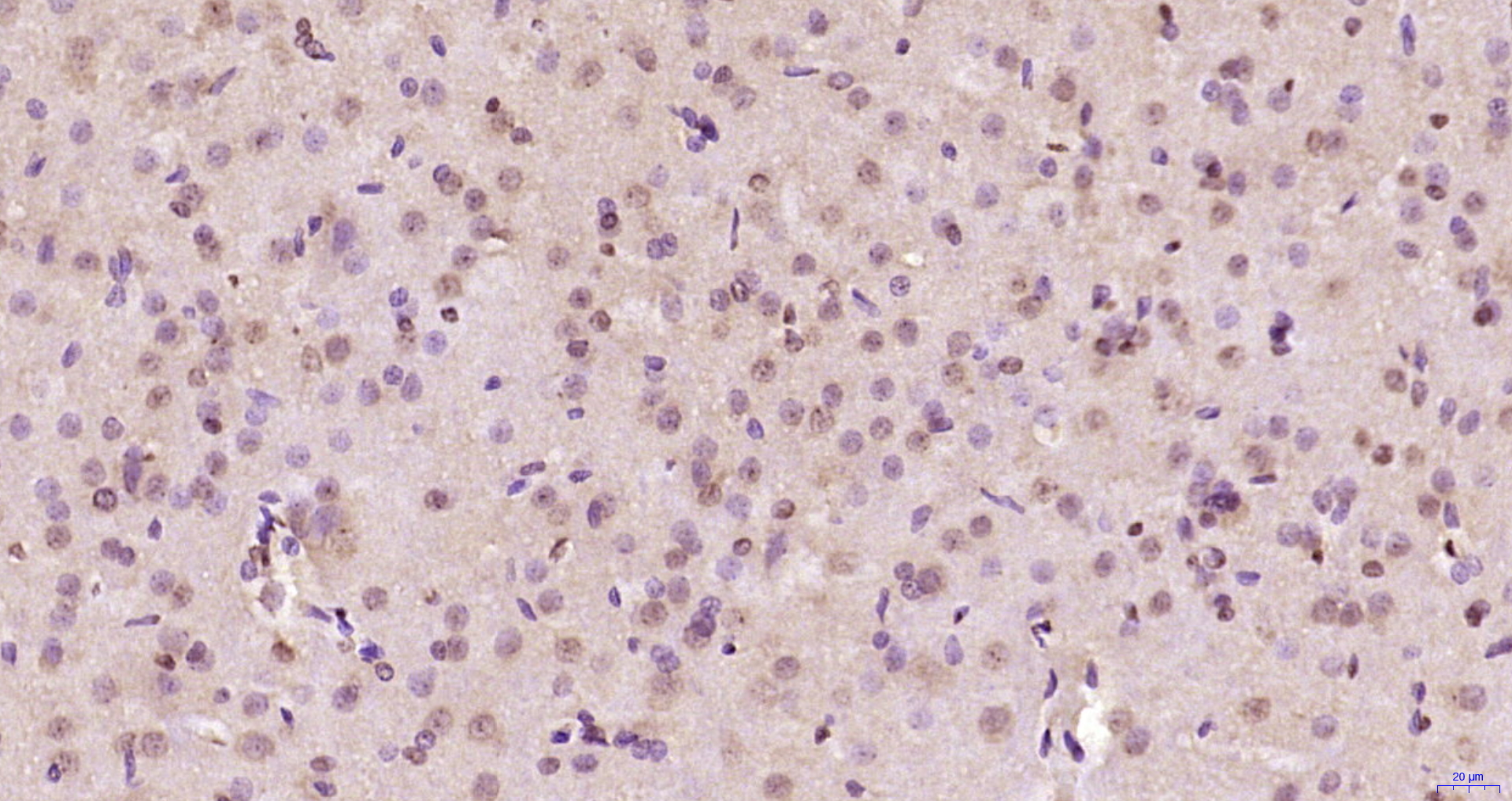 Paraformaldehyde-fixed, paraffin embedded Rat brain; Antigen retrieval by boiling in sodium citrate buffer (pH6.0) for 15min; Block endogenous peroxidase by 3% hydrogen peroxide for 20 minutes; Blocking buffer (normal goat serum) at 37°C for 30min; Antibody incubation with AHNAK2 Polyclonal Antibody, Unconjugated (bs-9094R) at 1:200 overnight at 4°C, DAB staining.