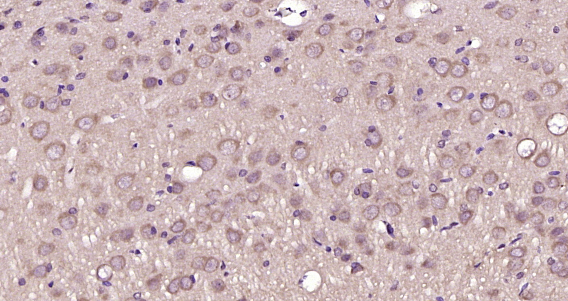 Paraformaldehyde-fixed, paraffin embedded Rat brain; Antigen retrieval by boiling in sodium citrate buffer (pH6.0) for 15min; Block endogenous peroxidase by 3% hydrogen peroxide for 20 minutes; Blocking buffer (normal goat serum) at 37°C for 30min; Antibody incubation with CSN1 Polyclonal Antibody, Unconjugated (bs-9126R) at 1:200 overnight at 4°C, DAB staining.