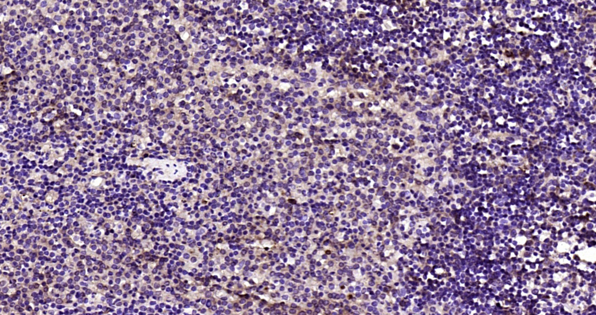 Paraformaldehyde-fixed, paraffin embedded Rat spleen; Antigen retrieval by boiling in sodium citrate buffer (pH6.0) for 15min; Block endogenous peroxidase by 3% hydrogen peroxide for 20 minutes; Blocking buffer (normal goat serum) at 37°C for 30min; Antibody incubation with CSN1 Polyclonal Antibody, Unconjugated (bs-9126R) at 1:200 overnight at 4°C, DAB staining.
