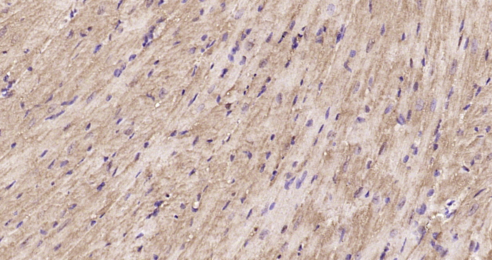 Paraformaldehyde-fixed, paraffin embedded Mouse heart; Antigen retrieval by boiling in sodium citrate buffer (pH6.0) for 15min; Block endogenous peroxidase by 3% hydrogen peroxide for 20 minutes; Blocking buffer (normal goat serum) at 37°C for 30min; Antibody incubation with CSN1 Polyclonal Antibody, Unconjugated (bs-9126R) at 1:200 overnight at 4°C, DAB staining.