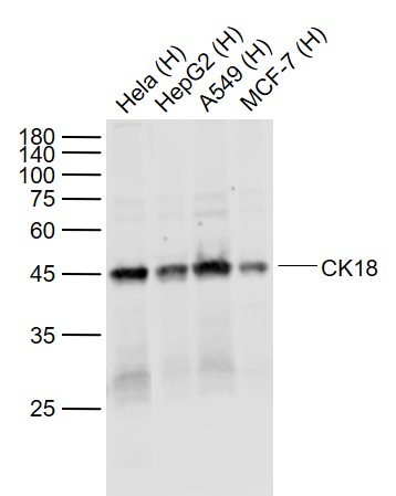 Lane 1: Human Hela cell lysates; Lane 2: Human HepG2 cell lysates; Lane 3: Human A549 cell lysates; Lane 4: Human MCF-7 cell lysates probed with CK18 Monoclonal Antibody, Unconjugated (bsm-33103M ) at 1:1000 dilution and 4˚C overnight incubation. Followed by conjugated secondary antibody incubation at 1:20000 for 60 min at 37˚C.