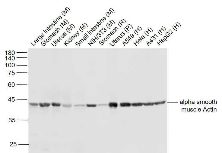 Lane 1: Mouse Large intestine lysates; Lane 2: Mouse Stomach lysates; Lane 3: Mouse Uterus lysates; Lane 4: Mouse Kidney lysates; Lane 5: Mouse Small intestine lysates; Lane 6: Mouse NIH/3T3 cell lysates; Lane 7: Rat Stomach lysates; Lane 8: Rat Uterus lysates; Lane 9: Human A549 cell lysates; Lane 10: Human Hela cell lysates; Lane 11: Human A431 cell lysates; Lane 12: Human HepG2 cell lysates probed with ACTA2 (3F9) Monoclonal Antibody, Unconjugated (bsm-33187M) at 1:1000 dilution and 4˚C overnight incubation. Followed by conjugated secondary antibody incubation at 1:20000 for 60 min at 37˚C.