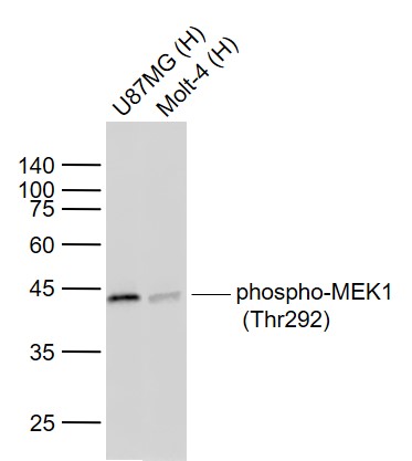 Lane 1: Human U-87MG cell lysates; Lane 2: Human MOLT-4 cell lysates probed with MEK1 Monoclonal Antibody, Unconjugated (bsm-52177R) at 1:1000 dilution and 4˚C overnight incubation. Followed by conjugated secondary antibody incubation at 1:20000 for 60 min at 37˚C.