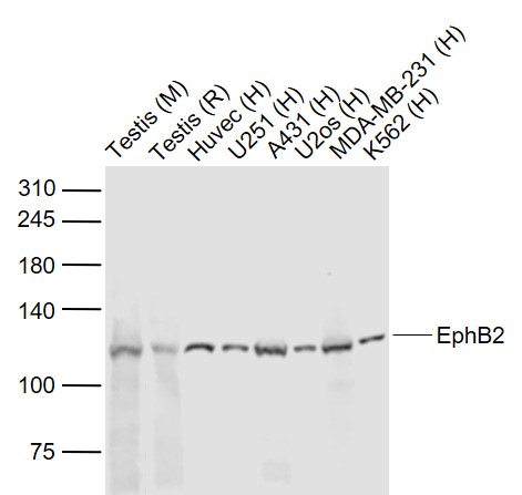 Lane 1: Mouse Testis lysates; Lane 2: Rat Testis lysates; Lane 3: Human HUVEC cell lysates; Lane 4: Human U251 cell lysates; Lane 5: Human A431 cell lysates; Lane 6: Human U-2OS cell lysates; Lane 7: Human MDA-MB-231 cell lysates; Lane 8: Human K562 cell lysates probed with EphB2 R Polyclonal Antibody, Unconjugated (bs-0247R) at 1:1000 dilution and 4˚C overnight incubation. Followed by conjugated secondary antibody incubation at 1:20000 for 60 min at 37˚C.