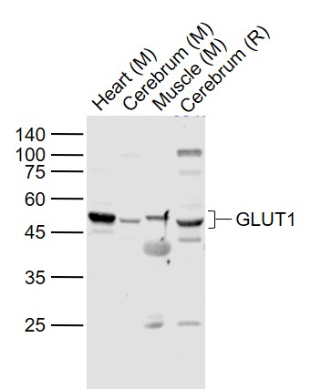 Lane 1: Mouse Heart lysates; Lane 2: Mouse Cerebrum lysates; Lane 3: Mouse Muscle lysates; Lane 4: Rat Cerebrum lysates probed with GLUT1 Polyclonal Antibody, Unconjugated (bs-0472R) at 1:1000 dilution and 4˚C overnight incubation. Followed by conjugated secondary antibody incubation at 1:20000 for 60 min at 37˚C.