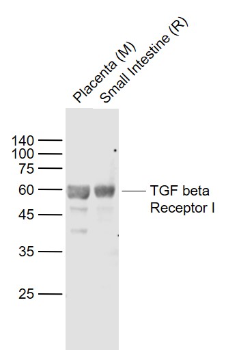 Lane 1: Mouse Placenta lysates; Lane 2: Rat Small intestine lysates probed with TGF Beta R1 Polyclonal Antibody, Unconjugated (bs-0638R) at 1:1000 dilution and 4˚C overnight incubation. Followed by conjugated secondary antibody incubation at 1:20000 for 60 min at 37˚C.