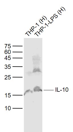 Lane 1: Human THP-1 cell lysates; Lane 2: Human THP-1-LPS\r\ncell lysates probed with IL-10 Polyclonal Antibody, Unconjugated (bs-0698R) at 1:1000 dilution and 4˚C overnight incubation. Followed by conjugated secondary antibody incubation at 1:20000 for 60 min at 37˚C.
