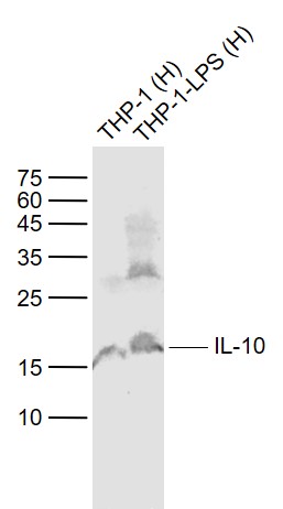 Lane 1: Human THP-1 cell lysates; Lane 2: Human THP-1-LPS_x000D_ cell lysates probed with IL-10 Polyclonal Antibody, Unconjugated (bs-0698R) at 1:1000 dilution and 4˚C overnight incubation. Followed by conjugated secondary antibody incubation at 1:20000 for 60 min at 37˚C.