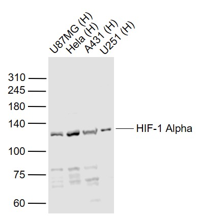 Lane 1: Human U-87MG cell lysates; Lane 2: Human Hela cell lysates; Lane 3: Human A431 cell lysates; Lane 4: Human U251 cell lysates probed with HIF-1 Alpha Polyclonal Antibody, Unconjugated (bs-0737R) at 1:1000 dilution and 4˚C overnight incubation. Followed by conjugated secondary antibody incubation at 1:20000 for 60 min at 37˚C.