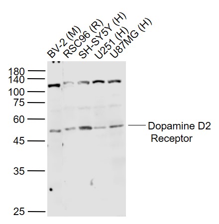 Lane 1: Mouse BV-2 cell lysates; Lane 2: Rat RSC96 cell lysates; Lane 3: Human SH-SY5Y cell lysates; Lane 4: Human U251 cell lysates; Lane 5: Human U-87MG cell lysates probed with DRD2 Polyclonal Antibody, Unconjugated (bs-1008R) at 1:1000 dilution and 4˚C overnight incubation. Followed by conjugated secondary antibody incubation at 1:20000 for 60 min at 37˚C.