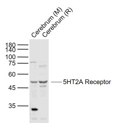 Lane 1: Mouse Cerebrum lysates; Lane 2: Rat Cerebrum lysates probed with 5-HTR2 Polyclonal Antibody, Unconjugated (bs-1056R) at 1:1000 dilution and 4˚C overnight incubation. Followed by conjugated secondary antibody incubation at 1:20000 for 60 min at 37˚C.