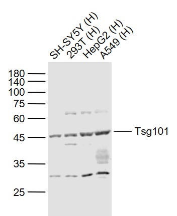 Lane 1: Human SH-SY5Y cell lysates; Lane 2: Human 293T cell lysates; Lane 3: Human HepG2 cell lysates; Lane 4: Human A549 cell lysates probed with Tsg101 Polyclonal Antibody, Unconjugated (bs-1365R) at 1:1000 dilution and 4˚C overnight incubation. Followed by conjugated secondary antibody incubation at 1:20000 for 60 min at 37˚C.