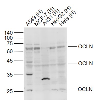 Lane 1: Human A549 cell lysates; Lane 2: Human MCF-7 cell lysates; Lane 3: Human A431 cell lysates; Lane 4: Human HepG2 cell lysates; Lane 5: Human Hela cell lysates probed with Occludin Polyclonal Antibody, Unconjugated (bs-1495R) at 1:1000 dilution and 4˚C overnight incubation. Followed by conjugated secondary antibody incubation at 1:20000 for 60 min at 37˚C.