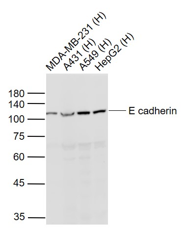 Lane 1: Human MDA-MB-231 cell lysates; Lane 2: Human A431 cell lysates; Lane 3: Human A549 cell lysates; Lane 4: Human HepG2 cell lysates probed with E Cadherin Polyclonal Antibody, Unconjugated (bs-1519R) at 1:1000 dilution and 4˚C overnight incubation. Followed by conjugated secondary antibody incubation at 1:20000 for 60 min at 37˚C.