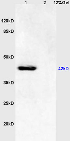 L1 mouse brain lysates L2 human colon carcinoma lysates probed with Anti - phospho-JNK1\/2\/3 (Thr183+Tyr185) Polyclonal Antibody, Unconjugated (bs-1640R) at 1:200 in 4˚C. Followed by conjugation to secondary antibody (bs-0295G-HRP) at 1:3000 90min in 37˚C. Predicted band 42kD. Observed band size: 42kD