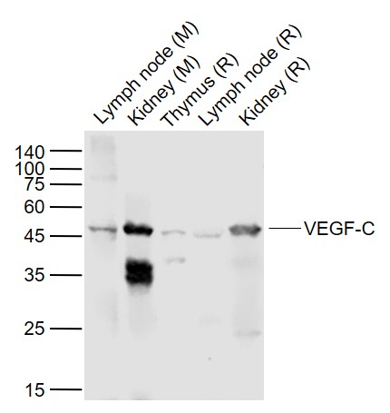 Lane 1: Mouse Lymph node lysates; Lane 2: Mouse Kidney lysates; Lane 3: Rat Thymus lysates; Lane 4: Rat Lymph node lysates; Lane 5: Rat Kidney lysates probed with VEGF-C Polyclonal Antibody, Unconjugated (bs-1586R) at 1:1000 dilution and 4˚C overnight incubation. Followed by conjugated secondary antibody incubation at 1:20000 for 60 min at 37˚C.