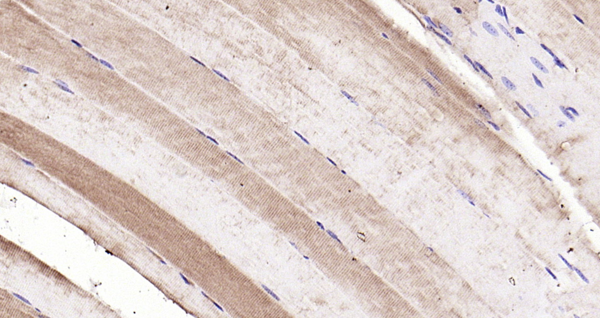 Paraformaldehyde-fixed, paraffin embedded Mouse muscle; Antigen retrieval by boiling in sodium citrate buffer (pH6.0) for 15min; Block endogenous peroxidase by 3% hydrogen peroxide for 20 minutes; Blocking buffer (normal goat serum) at 37°C for 30min; Antibody incubation with Integrin alpha 7 Polyclonal Antibody, Unconjugated (bs-1816R) at 1:200 overnight at 4°C, DAB staining.