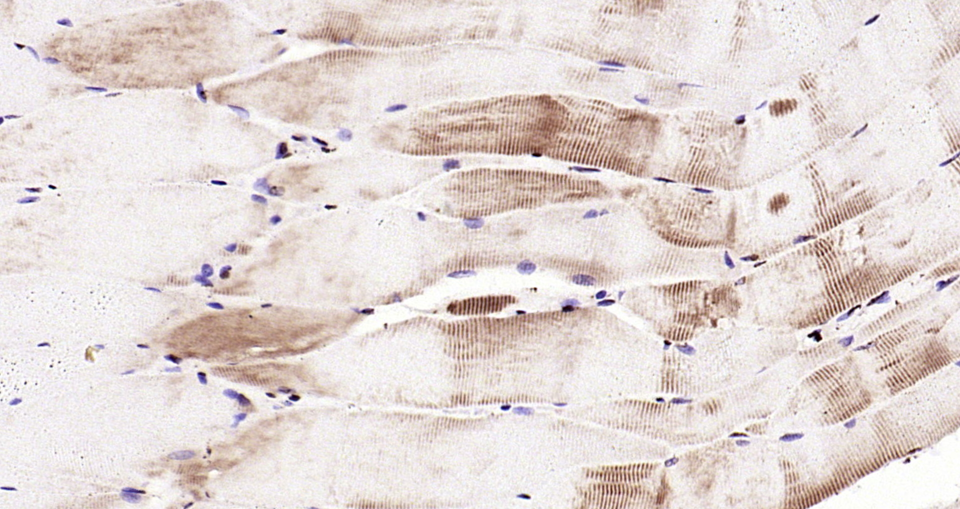 Paraformaldehyde-fixed, paraffin embedded Rat muscle; Antigen retrieval by boiling in sodium citrate buffer (pH6.0) for 15min; Block endogenous peroxidase by 3% hydrogen peroxide for 20 minutes; Blocking buffer (normal goat serum) at 37°C for 30min; Antibody incubation with HSP27 Polyclonal Antibody, Unconjugated (bs-0730R) at 1:200 overnight at 4°C, DAB staining.