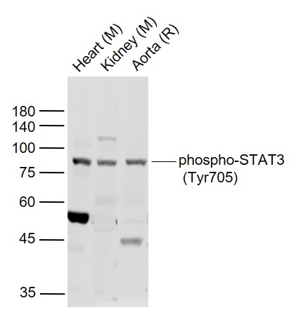 Lane 1: Mouse Heart lysates; Lane 2: Mouse Kidney lysates; Lane 3: Rat Aorta lysates probed with STAT3 Polyclonal Antibody, Unconjugated (bs-1658R) at 1:1000 dilution and 4˚C overnight incubation. Followed by conjugated secondary antibody incubation at 1:20000 for 60 min at 37˚C.
