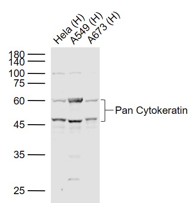 Lane 1: Human Hela cell lysates; Lane 2: Human A549 cell lysates; Lane 3: Human A673 cell lysates probed with pan Cytokeratin Polyclonal  Antibody, Unconjugated (bs-1712R) at 1:1000 dilution and 4˚C overnight incubation. Followed by conjugated secondary antibody incubation at 1:20000 for 60 min at 37˚C.