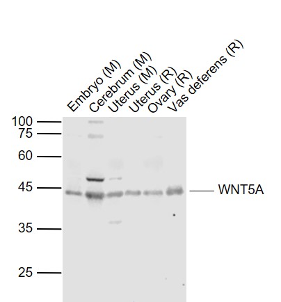 Lane 1: Mouse Embryo lysates; Lane 2: Mouse Cerebrum lysates; Lane 3: Mouse Uterus lysates; Lane 4: Rat Uterus lysates; Lane 5: Rat Ovary lysates; Lane 6: Rat Vas deferens lysates probed with WNT5A Polyclonal Antibody, Unconjugated (bs-1948R) at 1:1000 dilution and 4˚C overnight incubation. Followed by conjugated secondary antibody incubation at 1:20000 for 60 min at 37˚C.